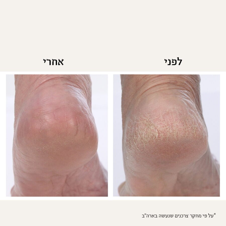 Foot Ba