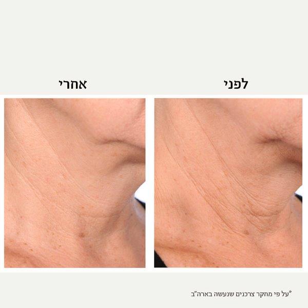 Neck Ba