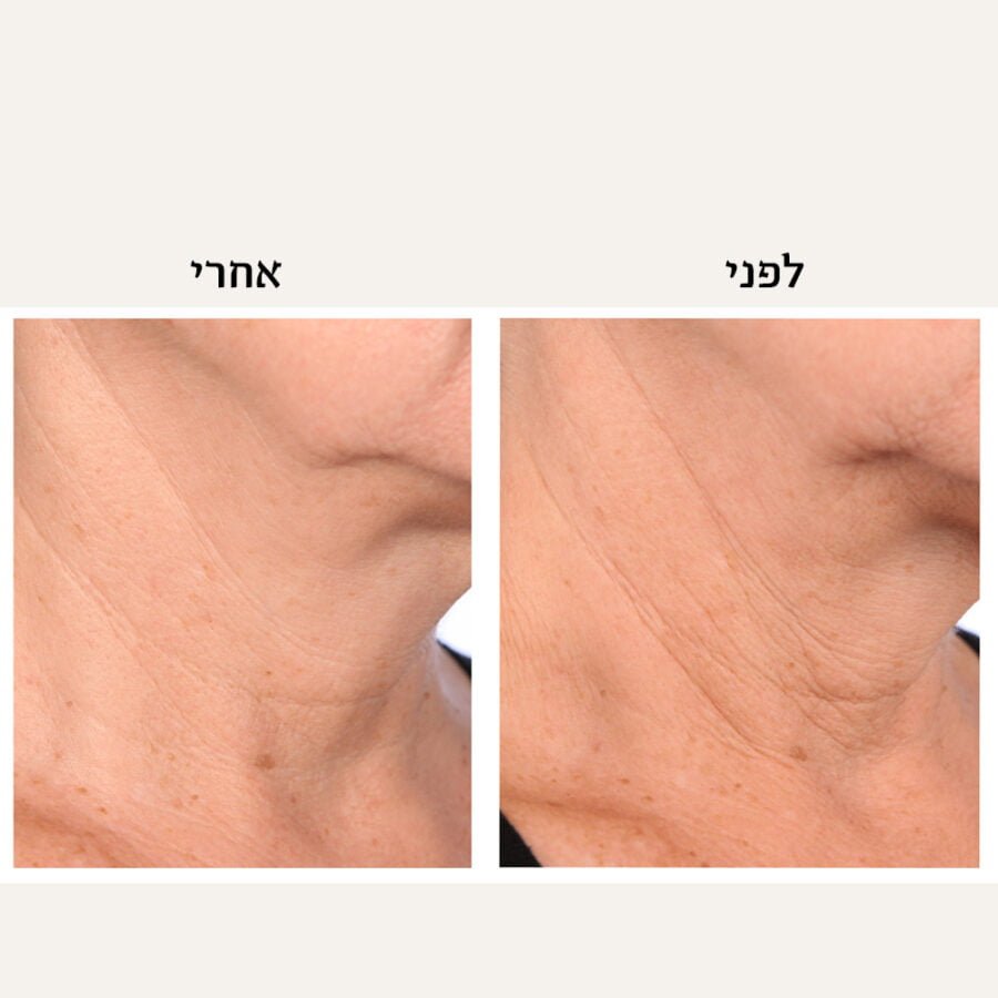 Neck Ba.jpg