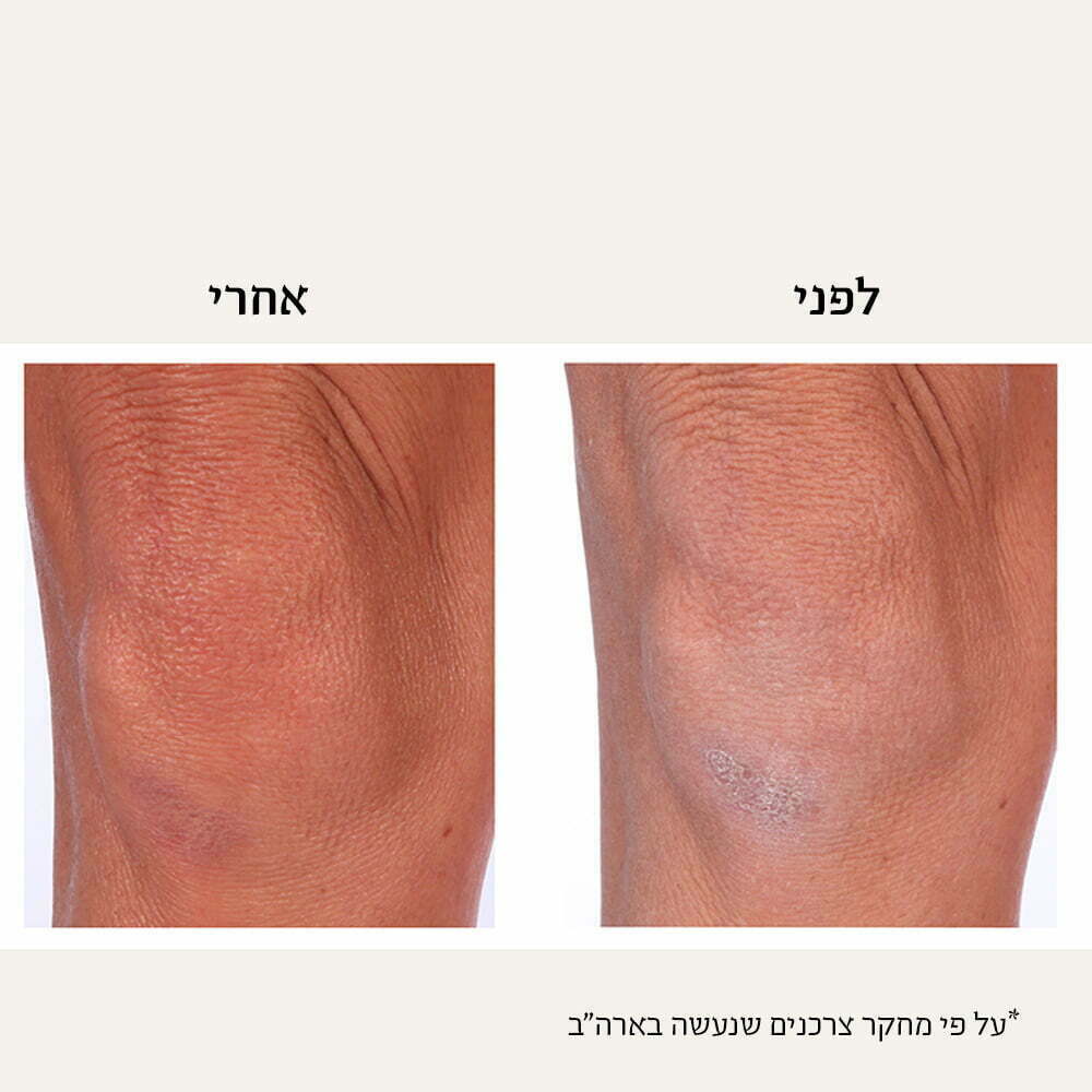 Thera Body Cream Ba2